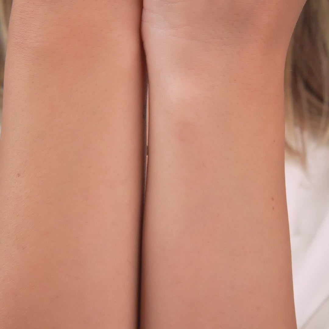 Close-up image of two arms, showcasing smooth skin tones and natural beauty, displayed against a soft background.
